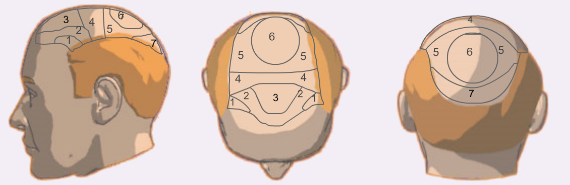 Zones